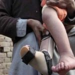 Polio case report