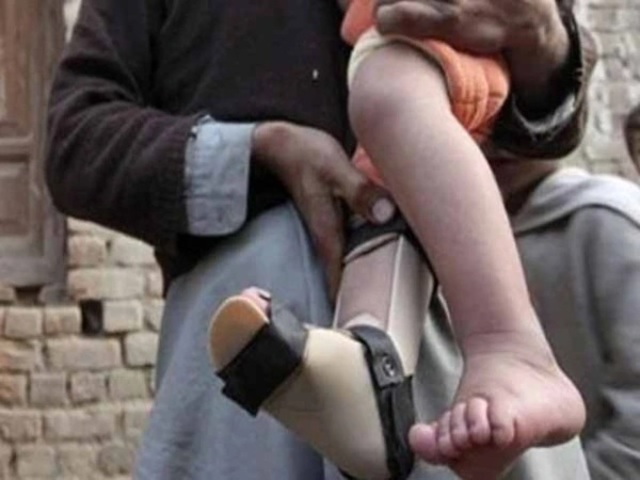 Polio case report